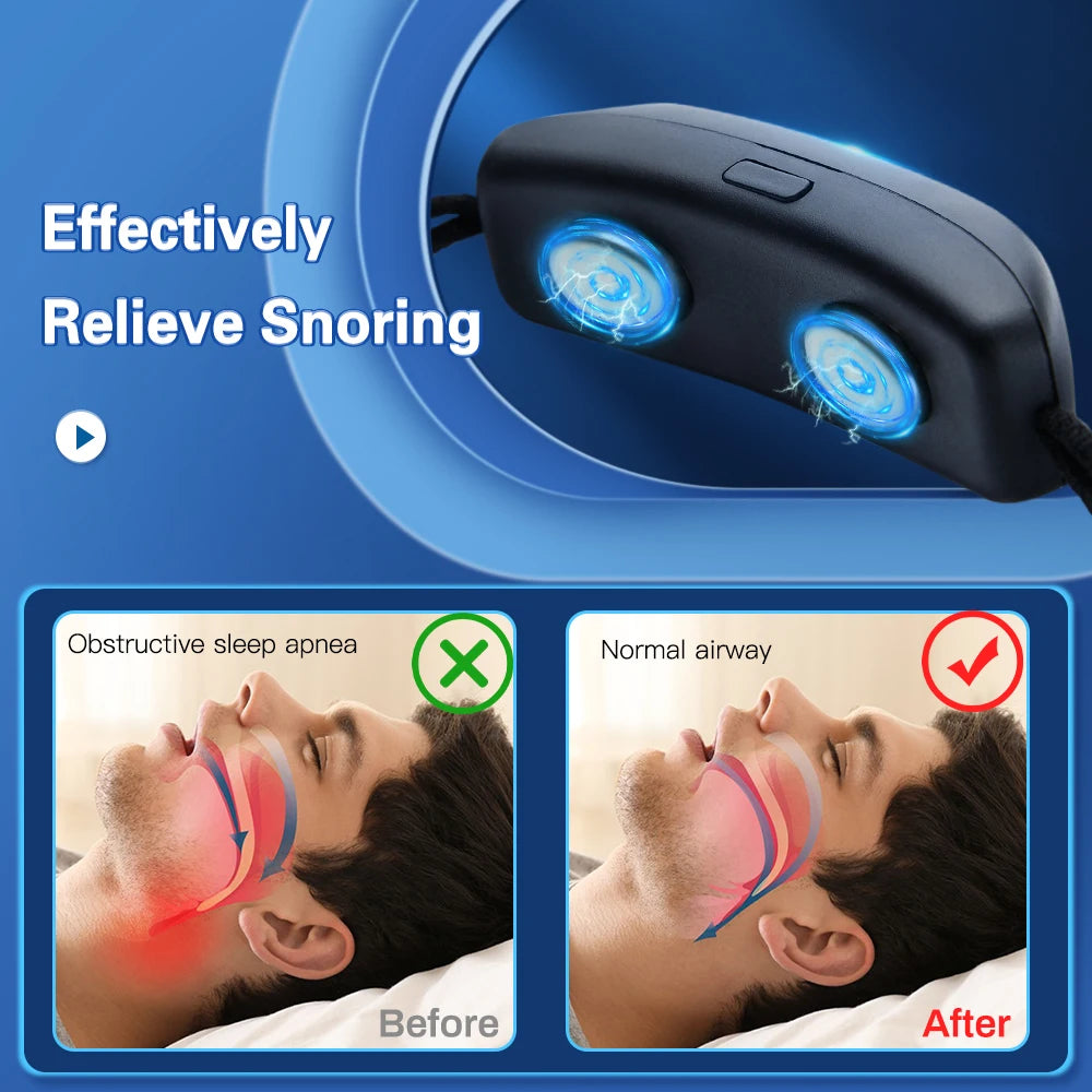 Anti-Snore Device | SnoringEase